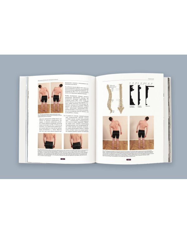 Фасциальный релиз для структурного баланса