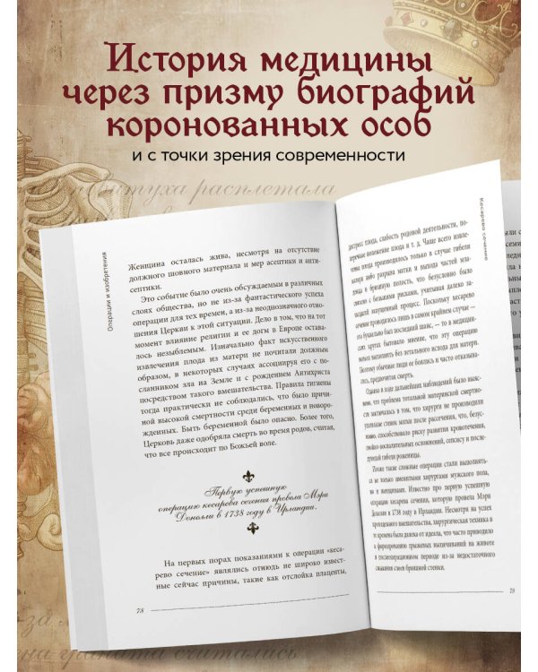 Королевская история медицины: как болели, лечились и умирали знатные дамы