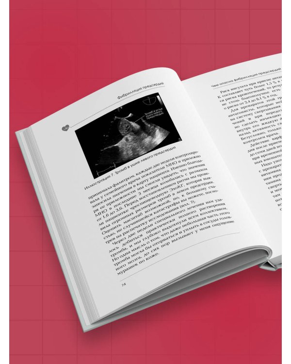 Стоп аритмия. Научные практики, которые помогут сердцу перестать сбиваться с ритма, а вам - жить в такт со своими желаниями