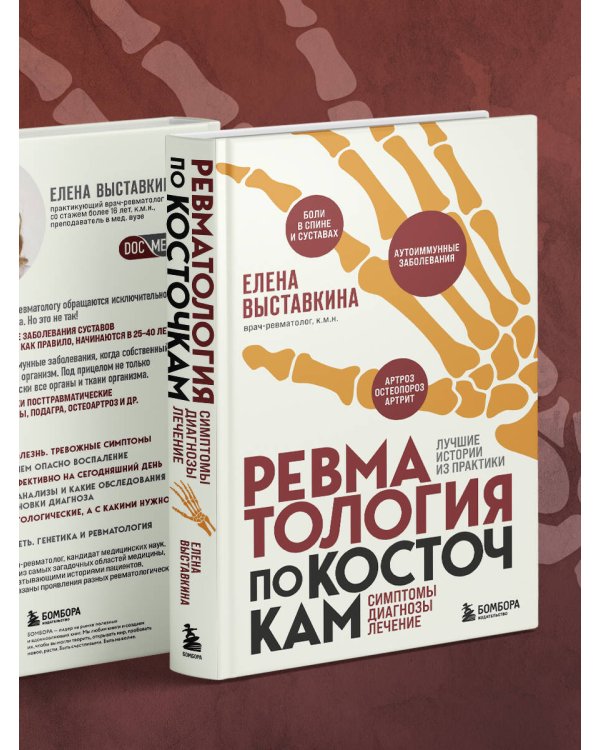 Ревматология по косточкам. Симптомы, диагнозы, лечение
