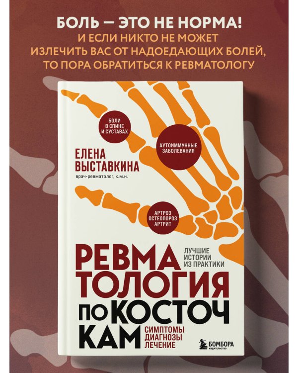 Ревматология по косточкам. Симптомы, диагнозы, лечение
