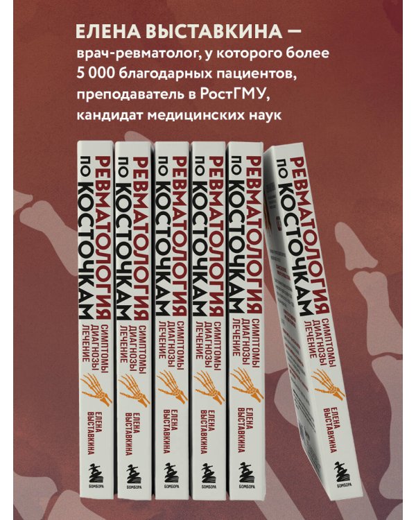 Ревматология по косточкам. Симптомы, диагнозы, лечение