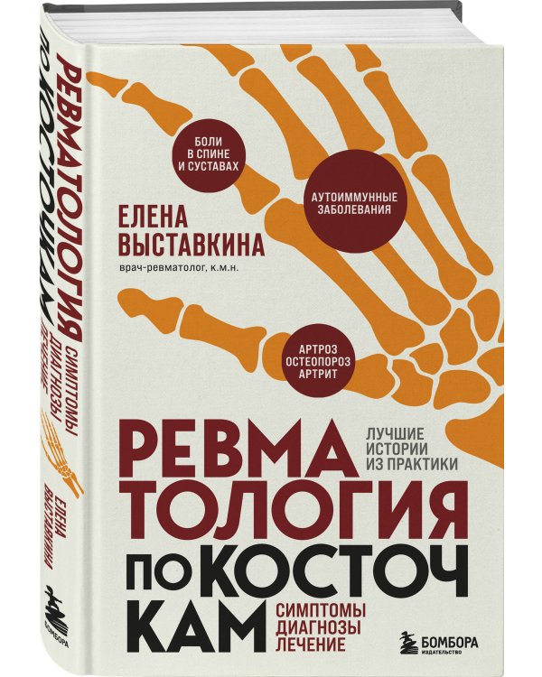 Ревматология по косточкам. Симптомы, диагнозы, лечение