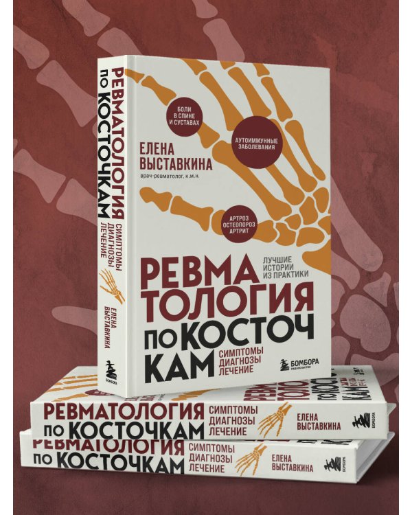 Ревматология по косточкам. Симптомы, диагнозы, лечение