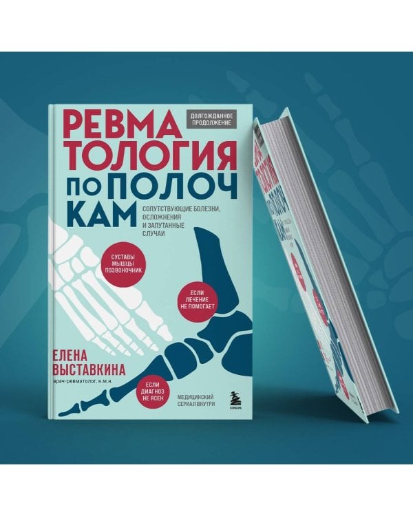 Ревматология по полочкам. Сопутствующие болезни, осложнения и запутанные случаи