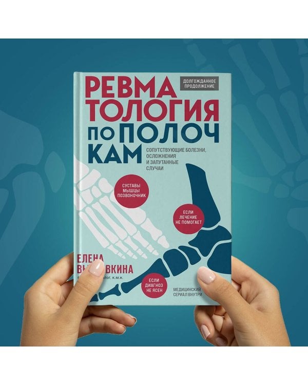 Ревматология по полочкам. Сопутствующие болезни, осложнения и запутанные случаи