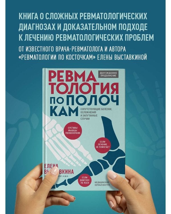 Ревматология по полочкам. Сопутствующие болезни, осложнения и запутанные случаи