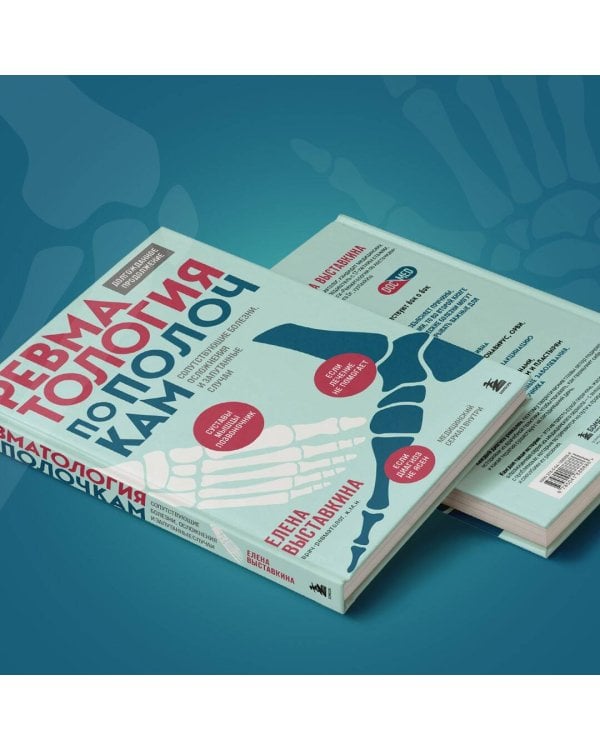 Ревматология по полочкам. Сопутствующие болезни, осложнения и запутанные случаи