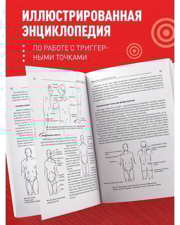 Синдром «замороженного» плеча. Терапия триггерных точек для преодоления боли и восстановления диапазона движений