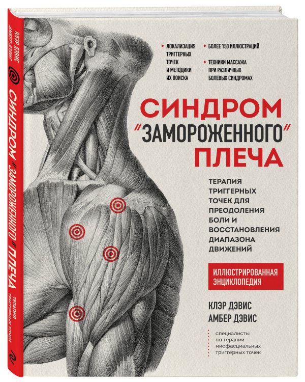 Синдром «замороженного» плеча. Терапия триггерных точек для преодоления боли и восстановления диапазона движений
