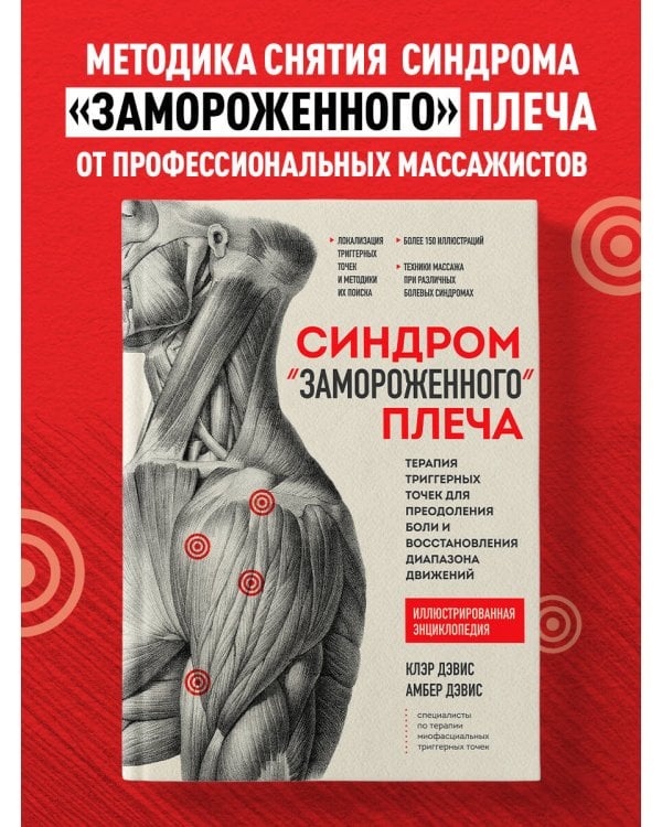 Синдром «замороженного» плеча. Терапия триггерных точек для преодоления боли и восстановления диапазона движений