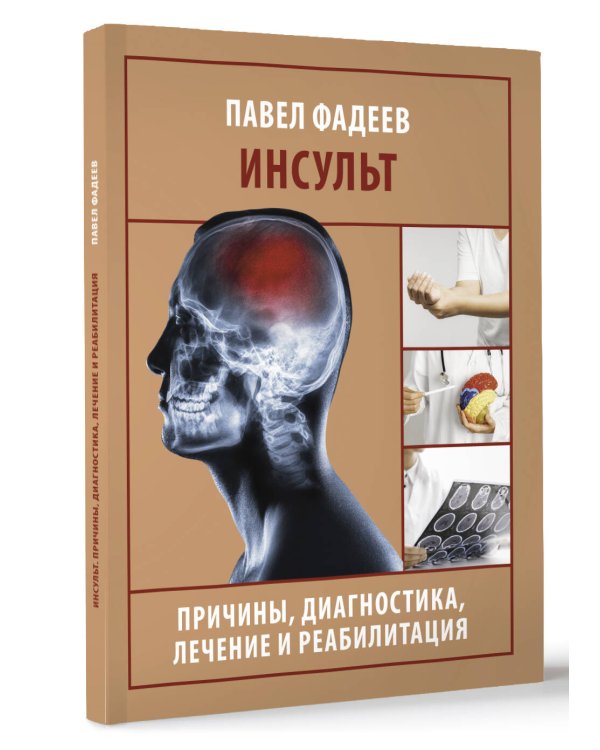 Инсульт. Причины, диагностика, лечение и реабилитация