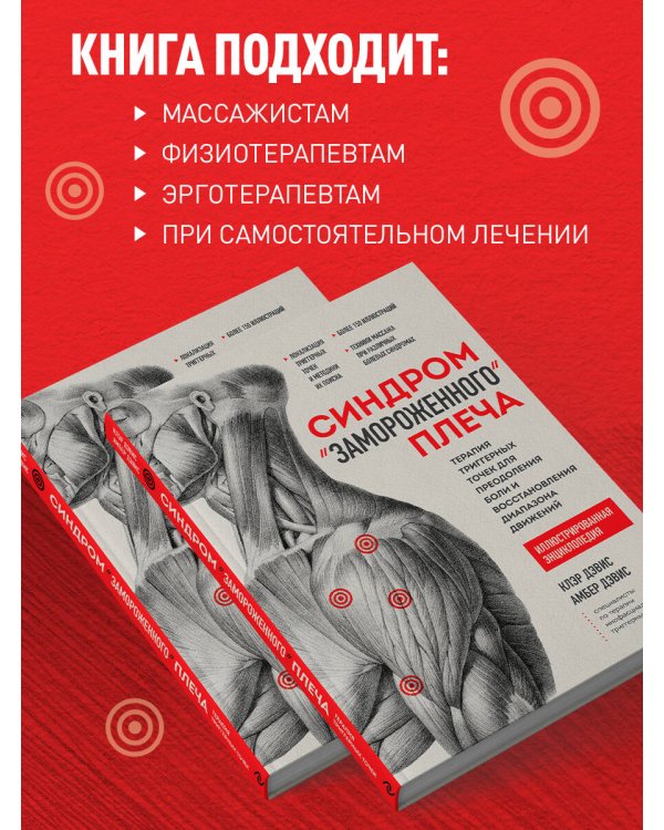 Синдром «замороженного» плеча. Терапия триггерных точек для преодоления боли и восстановления диапазона движений