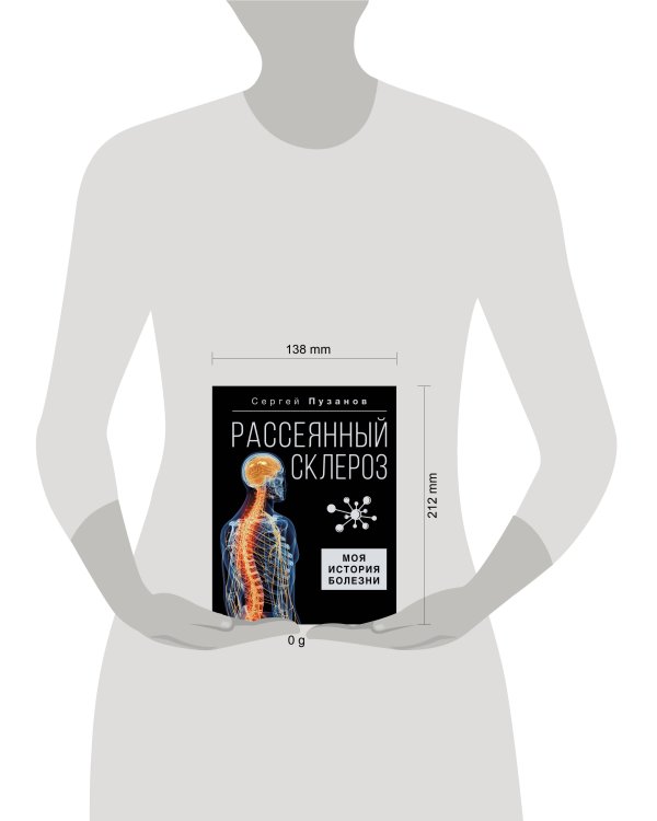 Рассеянный склероз. Моя история болезни