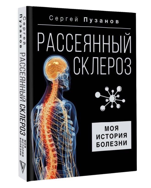 Рассеянный склероз. Моя история болезни