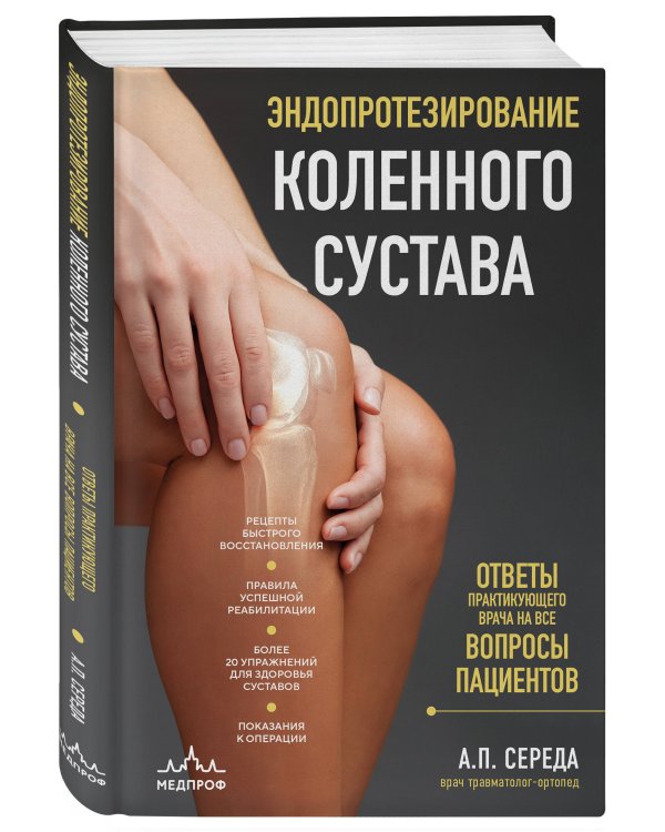Эндопротезирование коленного сустава: ответы практикующего врача на все вопросы пациентов