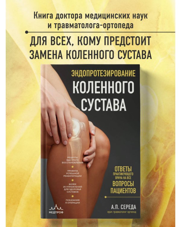 Эндопротезирование коленного сустава: ответы практикующего врача на все вопросы пациентов