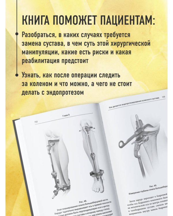 Эндопротезирование коленного сустава: ответы практикующего врача на все вопросы пациентов
