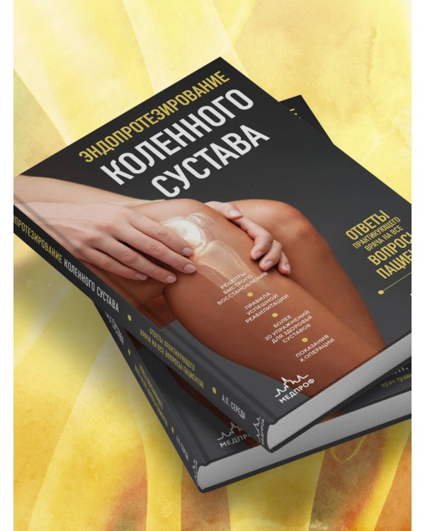 Эндопротезирование коленного сустава: ответы практикующего врача на все вопросы пациентов