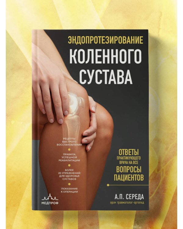 Эндопротезирование коленного сустава: ответы практикующего врача на все вопросы пациентов
