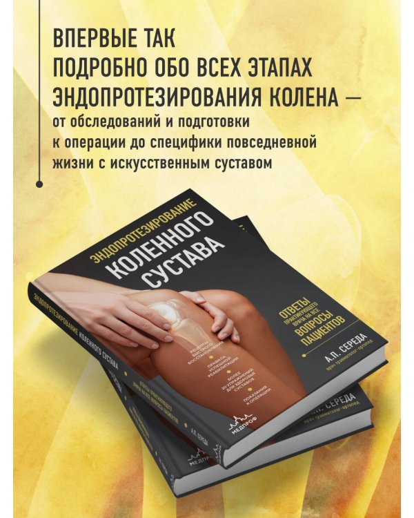 Эндопротезирование коленного сустава: ответы практикующего врача на все вопросы пациентов