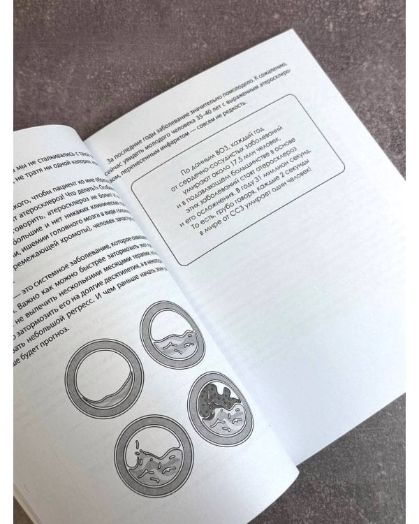 Атеросклероз. Все о лечении, диете и поддержании здоровья сосудов