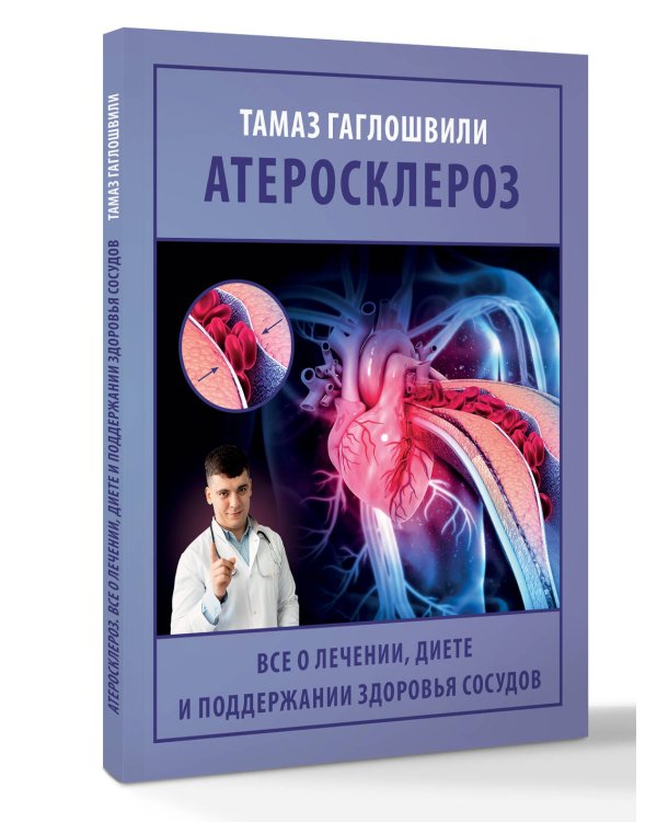 Атеросклероз. Все о лечении, диете и поддержании здоровья сосудов