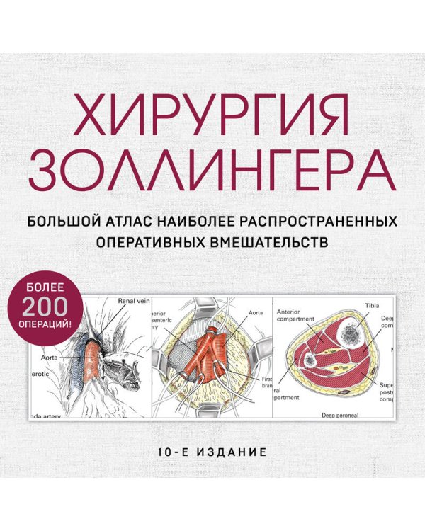Хирургия Золлингера. Большой атлас наиболее распространенных оперативных вмешательств
