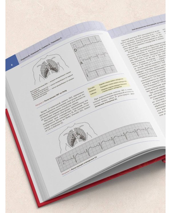 Атлас электрокардиографии. Интерпретация результатов: от простого к сложному
