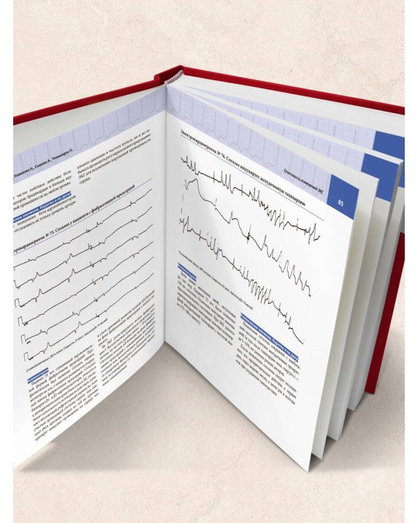 Атлас электрокардиографии. Интерпретация результатов: от простого к сложному