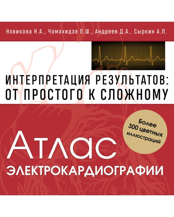 Атлас электрокардиографии. Интерпретация результатов: от простого к сложному