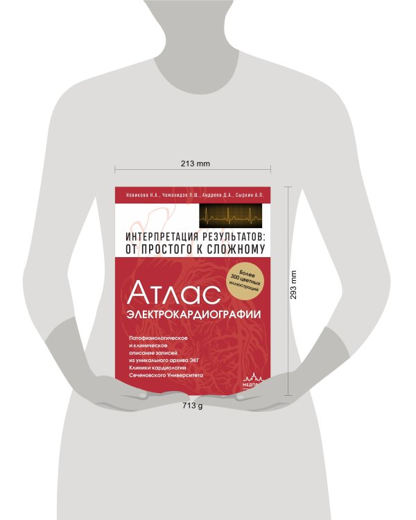 Атлас электрокардиографии. Интерпретация результатов: от простого к сложному