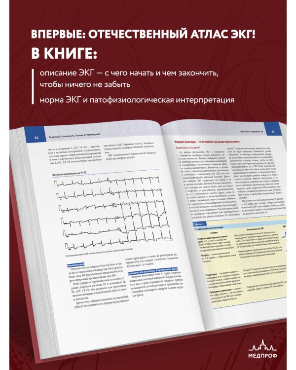 Атлас электрокардиографии. Интерпретация результатов: от простого к сложному