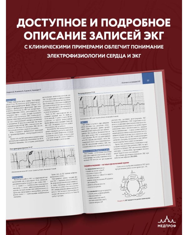 Атлас электрокардиографии. Интерпретация результатов: от простого к сложному