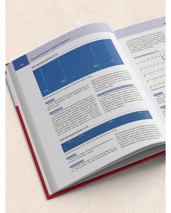 Атлас электрокардиографии. Интерпретация результатов: от простого к сложному