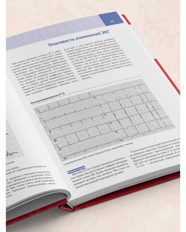 Атлас электрокардиографии. Интерпретация результатов: от простого к сложному