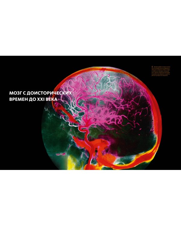 Большой атлас мозга