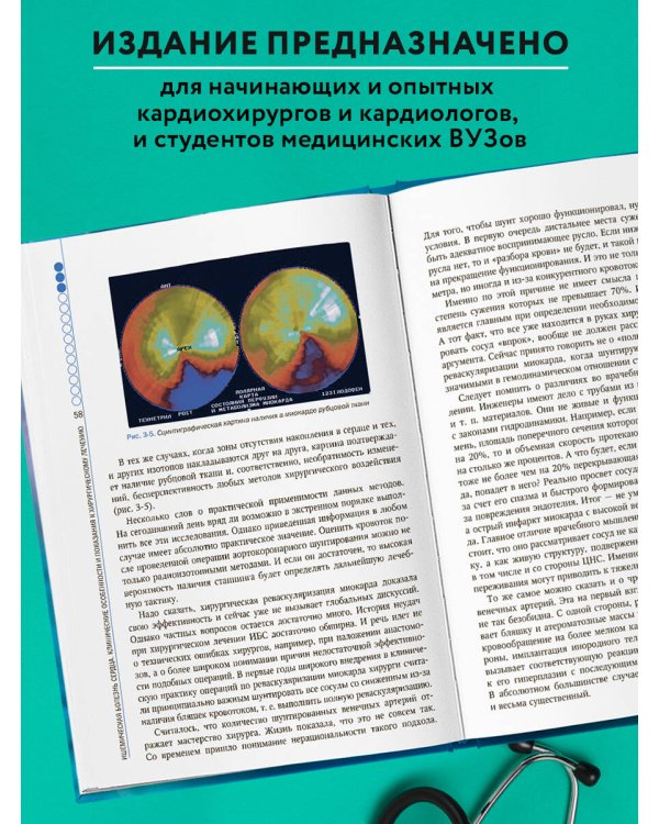 Клинические аспекты сердечно-сосудистой хирургии