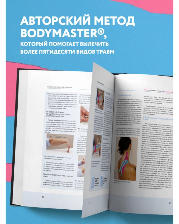 Кинезиологическое тейпирование