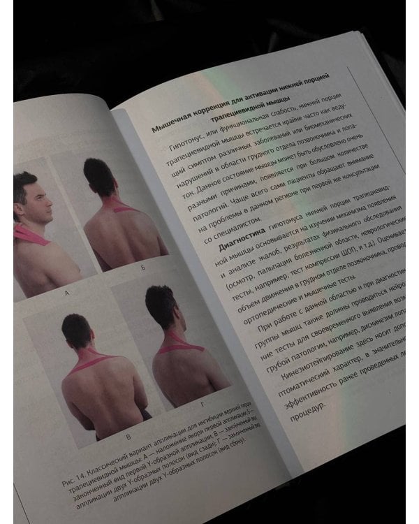 Тейп всему голова. Руководство по наложению волшебных ленточек