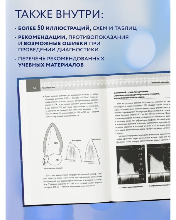 Эхокардиография для начинающих. Суть гемодинамических нарушений, позиции для анализа, определение тяжести порока. 2-е издание, исправленное и дополненное