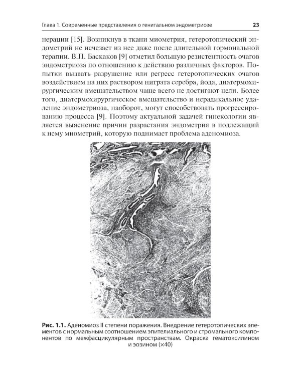 Генитальный эндометриоз. Новый взгляд на старые проблемы