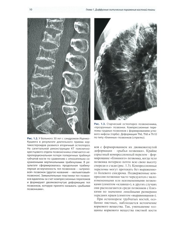 Лучевая диагностика патологии костной ткани. 2-е изд