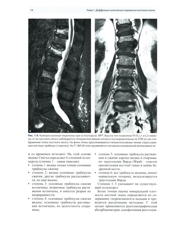 Лучевая диагностика патологии костной ткани. 2-е изд