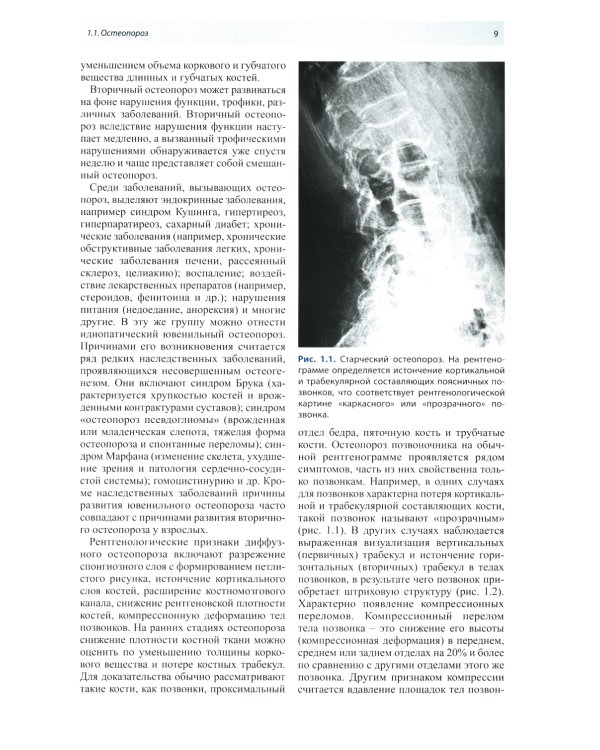 Лучевая диагностика патологии костной ткани. 2-е изд