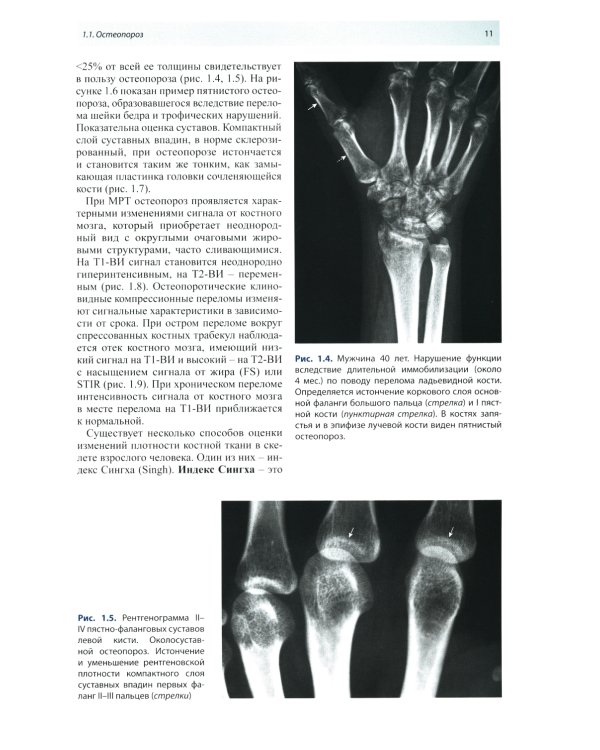 Лучевая диагностика патологии костной ткани. 2-е изд