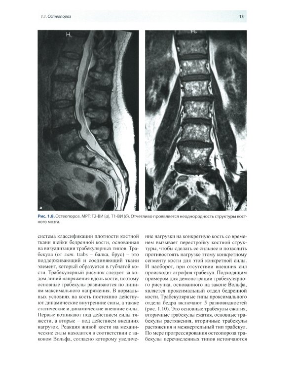 Лучевая диагностика патологии костной ткани. 2-е изд