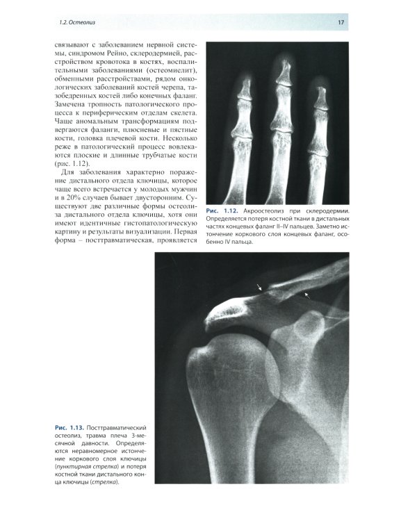Лучевая диагностика патологии костной ткани. 2-е изд