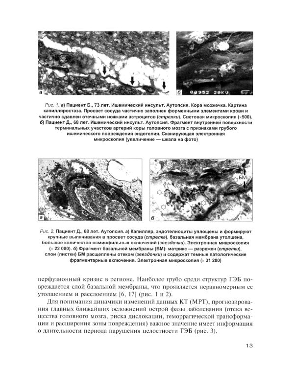 Неотложная клиническая нейрорадиология. Инсульт