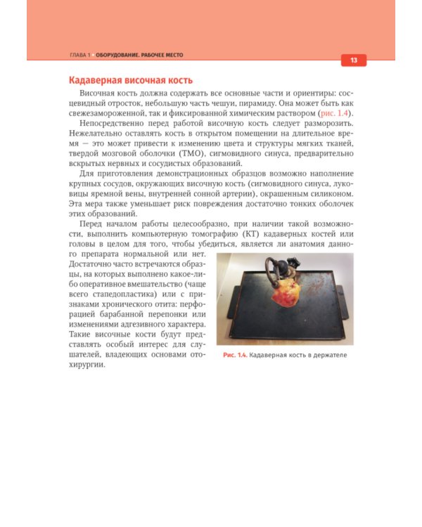 Анатомия височной кости. Отохирургический атлас: атлас для врачей